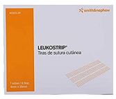 Leukostrip Hautnahtstreifen 4X76mm